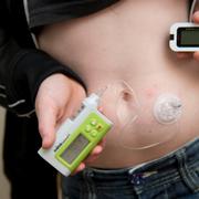 Barn med diabetes.