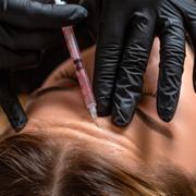 Giftet som finns i botox sägs vara bland de starkaste naturligt förekommande i världen. I Italien krävde det fyra dödsoffer i sommar. 