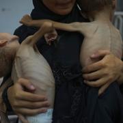 Palestinsk mamma med undernärda barn.