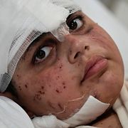 Ali Salman, 12, skadades i ett israeliskt luftanfall på tisdagen. Han vårdas på Jabal Amel-sjukhuset i Tyre i södra Libanon.