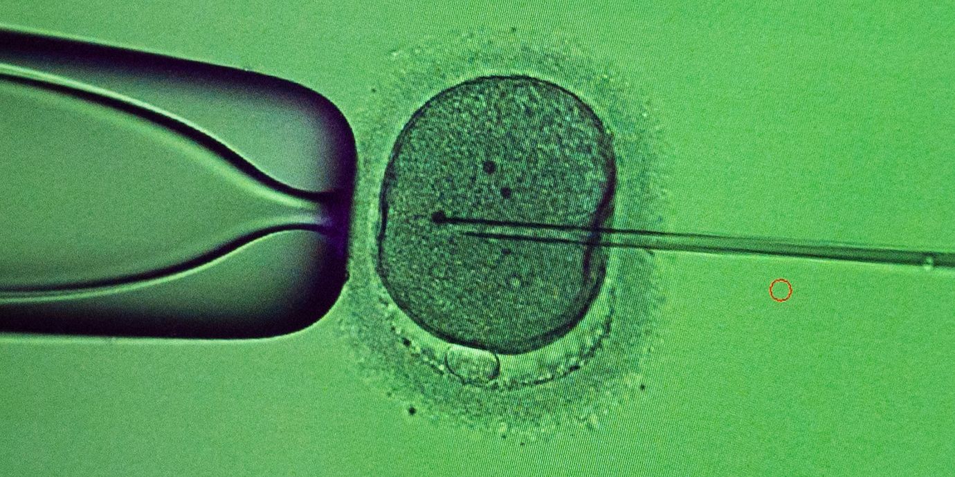 Fertilitetsbehandling. Arkivbild.