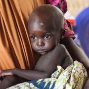 En flicka med akut undernäring vårdas på en Unicef klinik i delstaten Borno i nordöstra Nigeria.