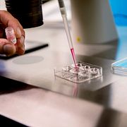 Fertilitetskliniken vid Gärdet där äggfrysning genomförs. Arkivbild