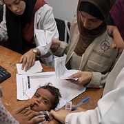 En läkare mäter ett barns arm i en undernäringskontroll på Al-Ahlisjukhuset i Gaza stad den 23 juli 2025.