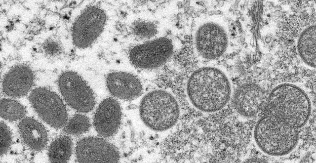 Mikroskopbild på apkoppsvirus. AP