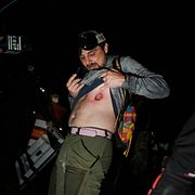 En ICE-demonstrant visar upp en skada i samband med protest i New Jersey 30 maj.