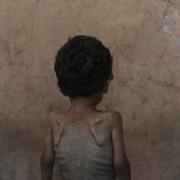 Tvåårige Yazan Abu Ful i flyktingläger i Gaza stad, 23 juli 2025. 