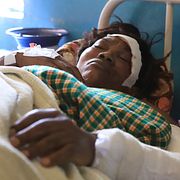 Margaret Chepkirui fick sitt ben amputerat av kollisionen.