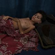 Pojke på sjukhus i Gaza.
