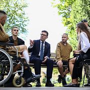 Burnham träffar krigsskadade i Ukraina, 24 augusti.