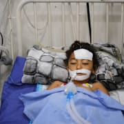 Nabila Shorbasi skadades när ett odetonerad föremål expoderade i Gaza City, 25 oktober. Utöver de direkta skadorna lider många Gazabor av sjukdom och död till följd av brister på rent vatten, mat och basala samhällsfunktioner.