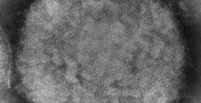 Apkoppsviruset under mikroskop. Cynthia S. Goldsmith, Russell Regner / AP