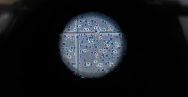 Coronaviruset i mikroskop. Kirsty Wigglesworth / AP