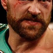 Tyson Fury efter matchen.