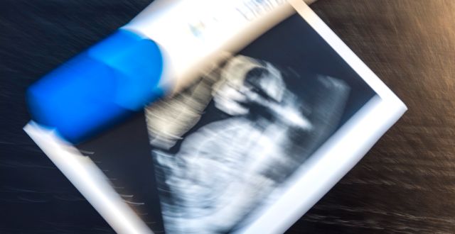 Graviditetstest och en ultraljudsbild. Gorm Kallestad / TT NYHETSBYRÅN