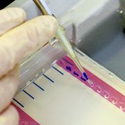 En forskare testar om ett prov innehåller DNA. Det är inte samma test som kommer kunna upptäcka medfödd risk för hjärtinfarkt. Arkivbild.