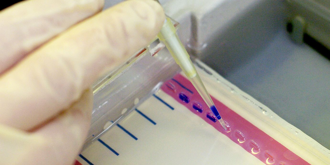 En forskare testar om ett prov innehåller DNA. Det är inte samma test som kommer kunna upptäcka medfödd risk för hjärtinfarkt. Arkivbild.