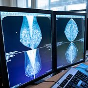 Illustrationsbild. En läkare tittar på bröströntgenbilder.