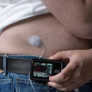 Den som har typ 1-diabetes behöver insulin, exempelvis via en automatisk pump. Arkivbild