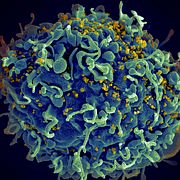 Hiv-virus i mikroskop.