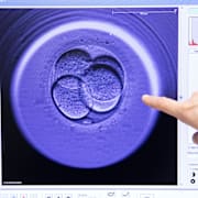 Ett mänskligt embryo sett i mikroskop.