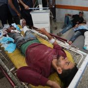 Skadade palestinier på Shifasjukhuset.