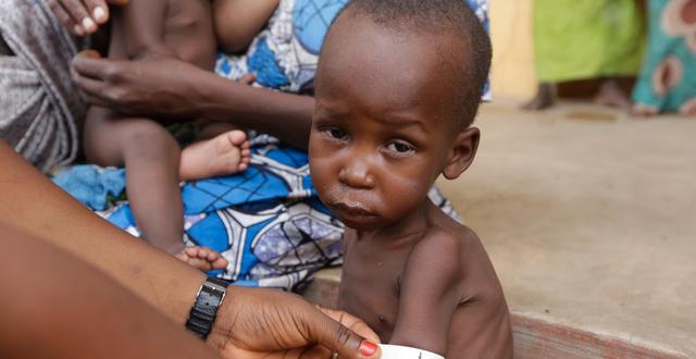 Undernärd pojke i ett flyktingläger i Nigeria Sunday Alamba / Ap