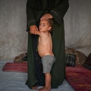 Mohammed Abu Hilal, 2, håller fast i sin mammas ben i ett tältläger i Khan Yunis, Gaza. 
