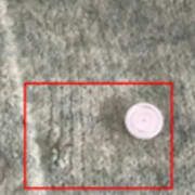 Konsumentverkets bild på koftan som återkallas. Den röda rutan visar på en knapp som riskerar att lossna. 