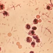 Shigella.