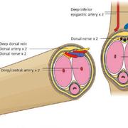 Schematisk bild som visar hur transplantationen gick till.