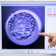 Ett mänskligt embryo.